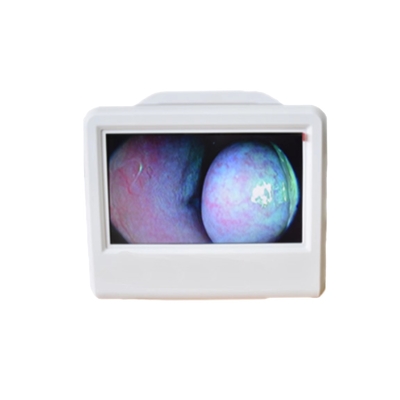 เครื่องตรวจสอบภาพอิเล็กทรอนิกส์ทางการแพทย์ ENT HD กล้องเอนโดสโคปแบบพกพา